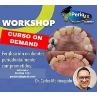 Ferulizacion en dientes periodontales comprometidos